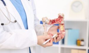 ליווי גסטרואנטרולוגי למטופלים בסיכון גנטי גבוה